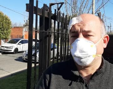 Recibió un disparo a quemarropa. El proyectil quedó alojado en el cuero cabelludo. Foto: Infocielo.