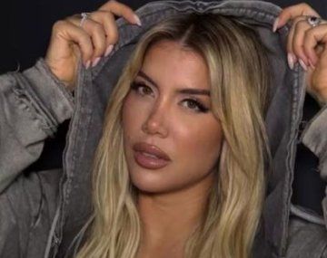 Wanda Nara consultó a sus seguidores antes de someterse a un nuevo retoque estético