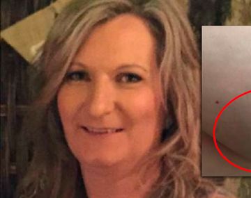 Facebook decidió dar de baja la foto de la mujer que mostró su cáncer