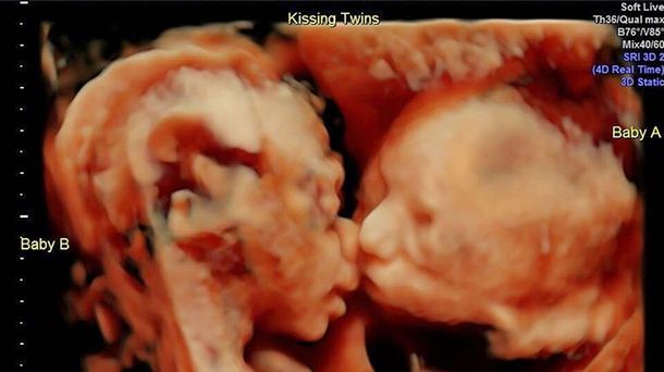 Isabella y Callie en la imagen más tierna