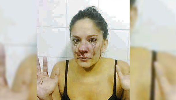 Brutal golpiza de una patota a una joven por cheta