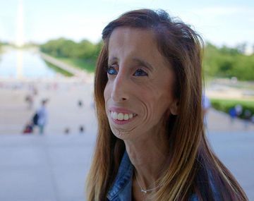 La extraña enfermedad de una chica