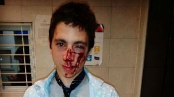 Bautista Beco mostró cómo quedó tras ser golpeado por una patota a la salida de un boliche Bautista Beco mostró cómo quedó tras ser golpeado por una patota a la salida de un boliche