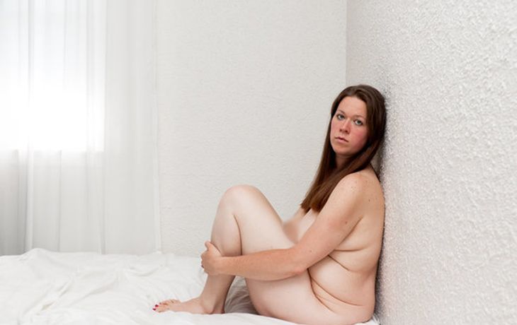 Una mujer muestra cómo quedó su cuerpo tras una drástica pérdida de peso