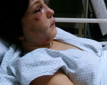 Tiene golpes en la cara y en la espalda. Todavia no puede escuchar de un oído