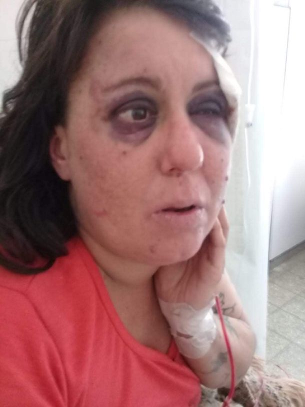 Comisario de San Clemente del Tuyú Roberto Romero acusado de golpear a un paciente psiquiátrica