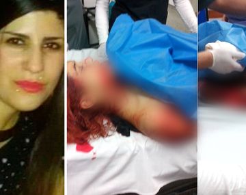 Se entregó la joven que atacó con un cúter a la actual pareja de su ex