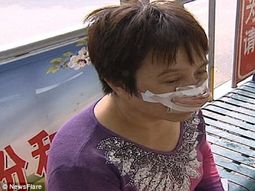 Le comió la nariz porque no le contestó