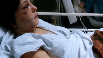 Tiene golpes en la cara y en la espalda. Todavia no puede escuchar de un oído Tiene golpes en la cara y en la espalda. Todavia no puede escuchar de un oído