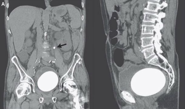 Las radiografías mostraron el estado apremiante del paciente