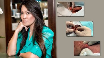 te va a dar asco: conoce a la dermatologa que se hizo famosa en instagram te va a dar asco: conoce a la dermatologa que se hizo famosa en instagram