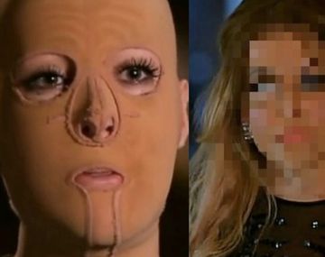 La increíble transformación de la mujer a la que le quemaron 60% del cuerpo