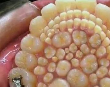 Le sacaron 232 dientes - Crédito: Diario Uno