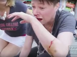 video: un pitbull ataco ferozmente a un beagle en la calle video: un pitbull ataco ferozmente a un beagle en la calle