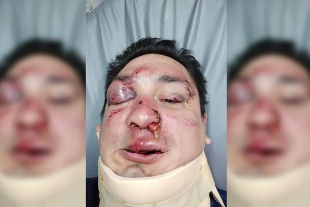 Sebastián Acosta fue brutalmente agredido por barras bravas de Rcaing.