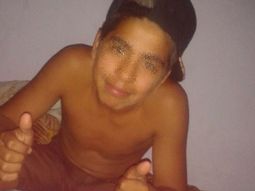 el chico alcanzado por un rayo esta bien el chico alcanzado por un rayo esta bien