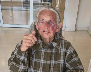 Virrey del Pino: salvaje ataque a una anciana durante un robo