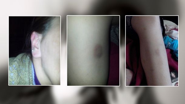 El conmovedor relato de una joven víctima de violencia de género