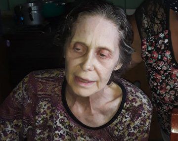 Máxima preocupación por la salud de Camila Perissé: Está destruida y muy triste