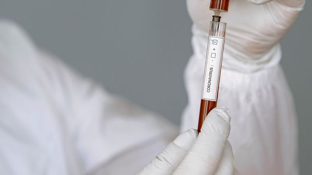 Un estudio reveló cuánto duran los anticuerpos en los recuperados de coronavirus