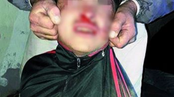 La foto del ladrón linchado por vecinos La foto del ladrón linchado por vecinos