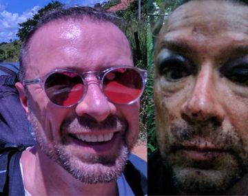 Sufrió un accidente, se sacó una selfie y descubrió que casi muere