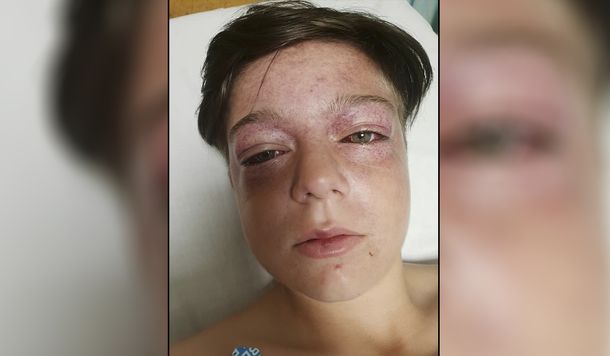 Calesita de la muerte: el nuevo y peligroso desafío viral que alarma