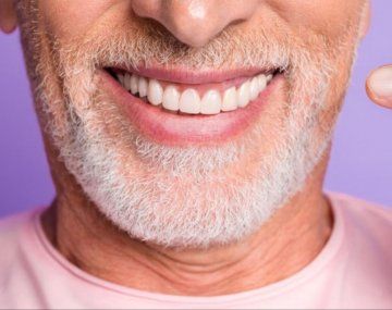 ANMAT prohibió unos implantes dentales: qué marca no hay que usar