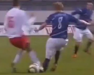 La lesión más impresionante: se rompió la tibia