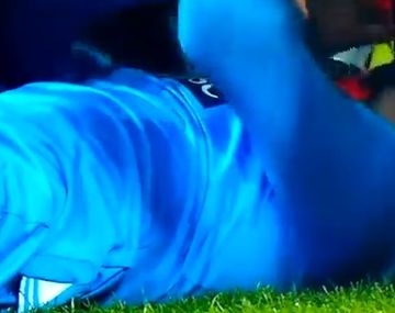 Un futbolista uruguayo del Nápoli se fracturó la mandíbula