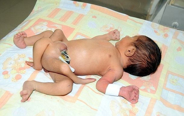 Bebé de 6 piernas3