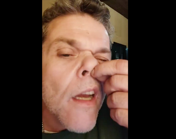 Casero se arrancó un pelo de la nariz para demostrar que no toma cocaína