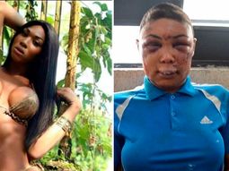 conmocion por la trans desfigurada por la policia de brasil conmocion por la trans desfigurada por la policia de brasil