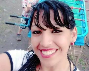 Tiene el 85% del cuerpo quemado y alcanzó a denunciar a su pareja: Lo hizo él