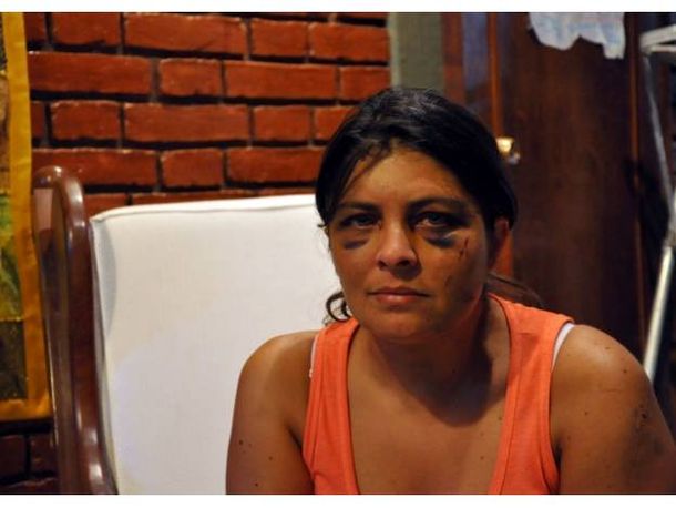 La mujer golpeada en Mendoza dijo que la quisieron matar
