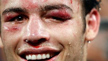 ahora el promotor de chavez pide legalizar la marihuana ahora el promotor de chavez pide legalizar la marihuana