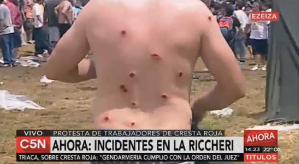 VIDEO: Así resultó herido un manifestante en la protesta de Cresta Roja
