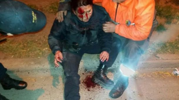 Así quedó la mujer policía atropellada