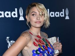 La modelo se suma a la tendencia de axilas peludas