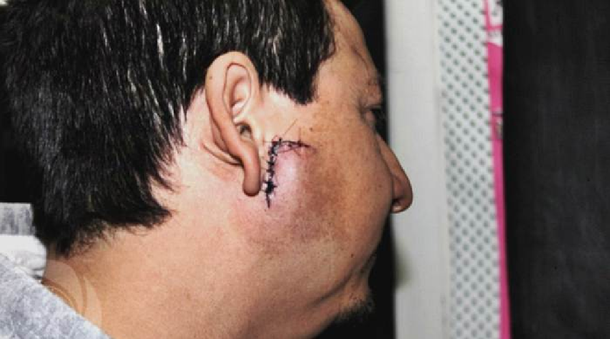 Tres Arroyos: Le piropearon a la mujer y los agarró a tablazos