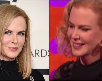 Nicole Kidman reapareció en TV con un rostro que apenas se dejó mover