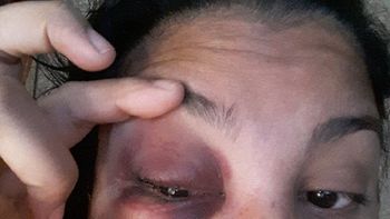 Ex mujer del jugador Mazzacote denunció violencia de género Ex mujer del jugador Mazzacote denunció violencia de género