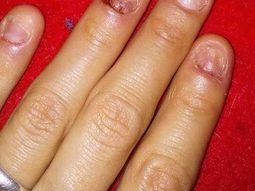 Tiene las manos así y pide ayuda por Facebook