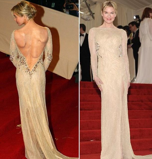 Espalda de actriz trasluce huesos