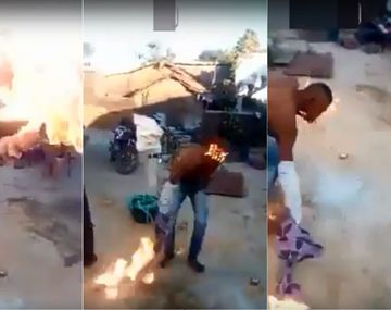 VIDEO: Quiso hacer un truco con fuego y se quemó la cara
