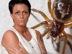 perdio un dedo tras ser mordida por una arana perdio un dedo tras ser mordida por una arana