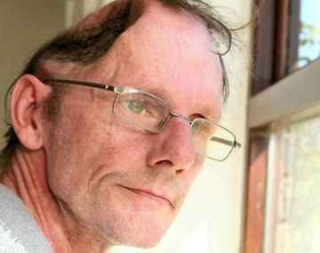 Sin la mitad del cráneo