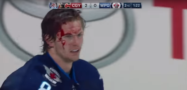 Una pelea en un partido de hockey sobre hielo terminó mal
