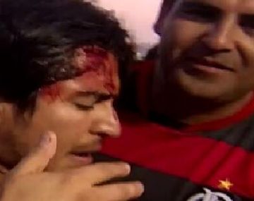 Hubo heridos tras un cruce entre hinchas argentinos y chilenos en Copacabana