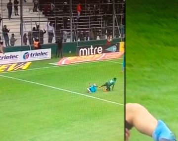 La escalofriante fractura expuesta que sufrió un jugador de Temperley